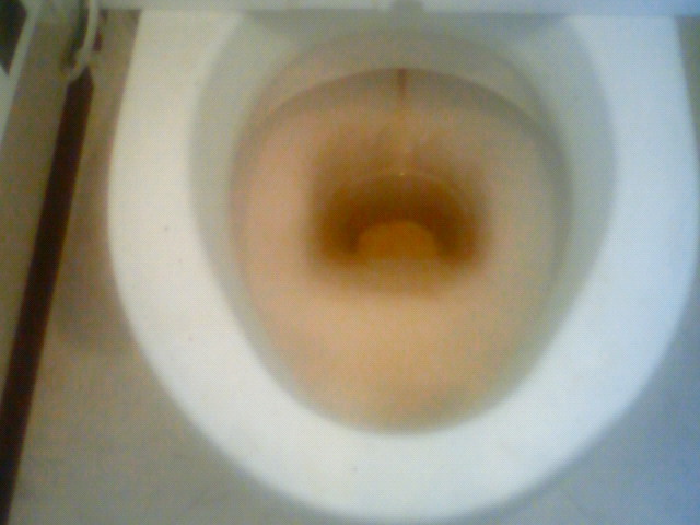 トイレ便器クリーニングはこんなに汚れています